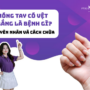 Móng tay có vệt trắng là bệnh gì? nguyên nhân và cách chữa trị