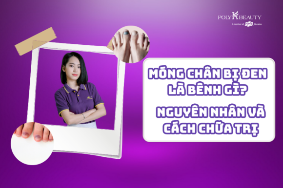 móng chân bị đen là bênh gì? nguyên nhân và cách chữa trị