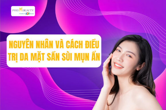 Nguyên nhân và cách điều trị da mặt sần sùi mụn ẩn