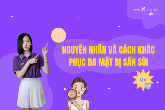 Nguyên nhân dẫn đến da mặt bị sần sùi không mịn màng? Cách khắc phục đơn giản tại nhà