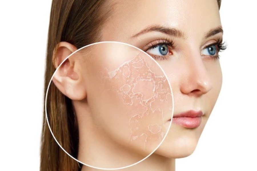 Nguyên nhân khiến da mặt bị sần sùi, không mịn màng