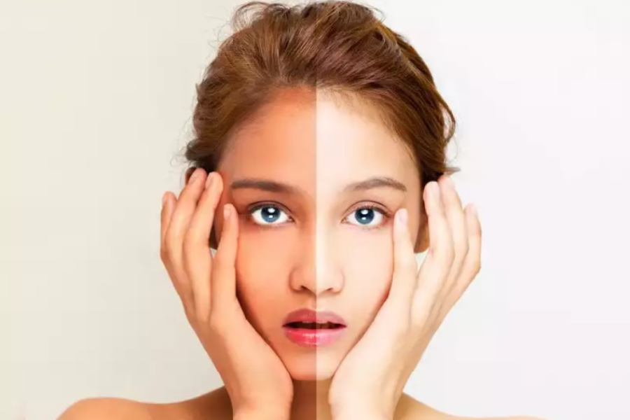Nguyên nhân khiến da mặt bị cháy nắng và trở nên sạm đen
